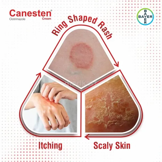 canesten cream 30 gm